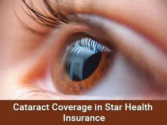 Cataract Coverage in Star Health Insurance